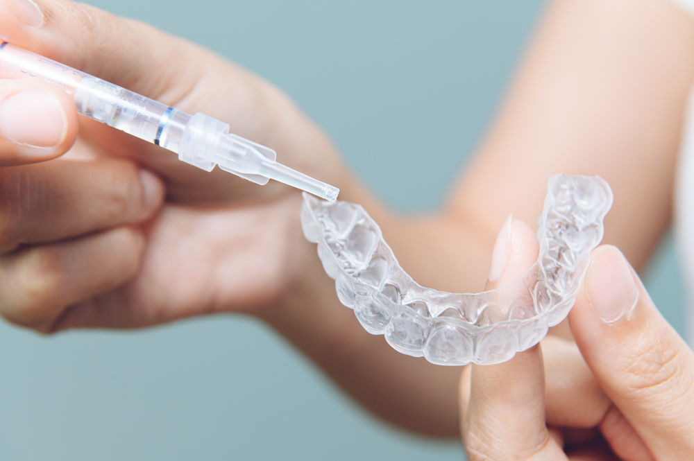 How Invisalign works for teeth whitening